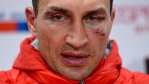 Wladimir Klitschko is planning on coming forward and throwing more punches in the rematch. 